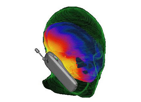Radiación producida en la cabeza del usuario de telefonía móvil - Imagen de mix.fresqui.com