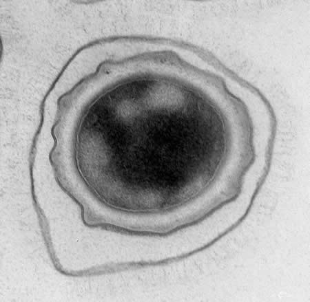 Científicos del Instituto Tecnológico de Georgia han desarrollado un nuevo método que permite conocer en detalle el genoma de la bacteria que causa el Anthrax - Imagen del Instituto Tecnológico de Georgia