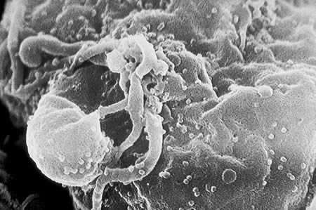 Viriones del VIH-1 ensamblándose en la superficie de un linfocito - Imagen de la Wikipedia