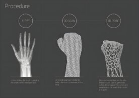 cortex-yeso-ferula-3d-print